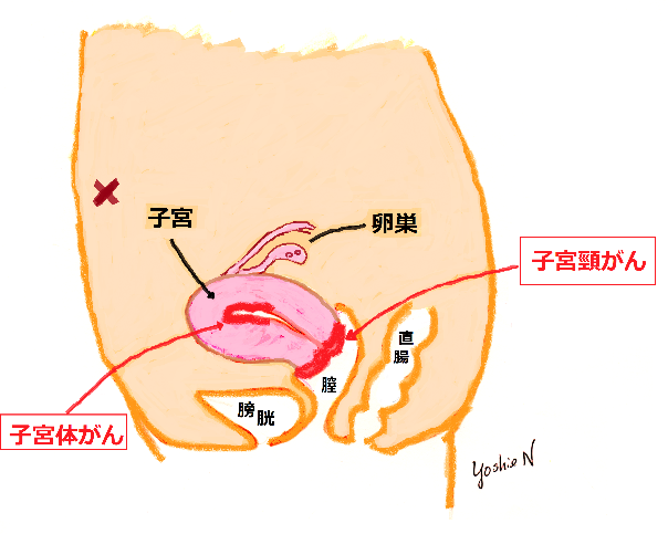 ん 検診 体 が 子宮 子宮がん検診｜がん検診｜公益財団法人東京都予防医学協会「元気で長生き」をめざす皆さんをサポートしています。